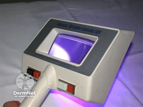 dermnet lamp skin exam